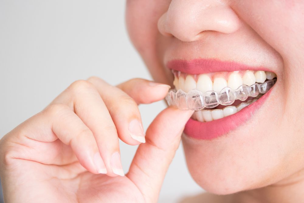 How Much Do Braces Cost in New Jersey