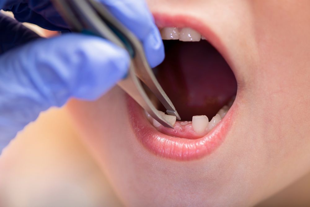 Why Dentistry for Children Is Crucial for Their Health