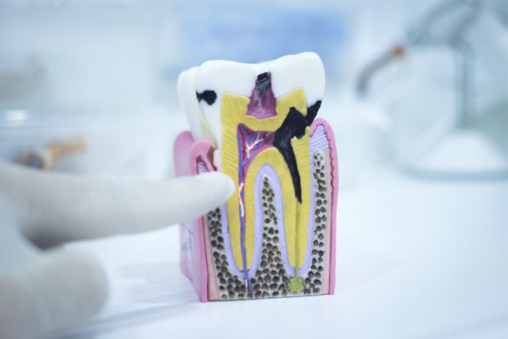 How to Protect Yourself from Tooth Decay: Effective Tips and Tricks