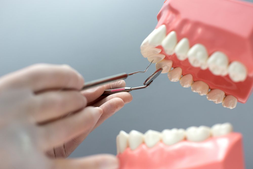 Dental Crowns: What You Need to Know About Dental Crowns