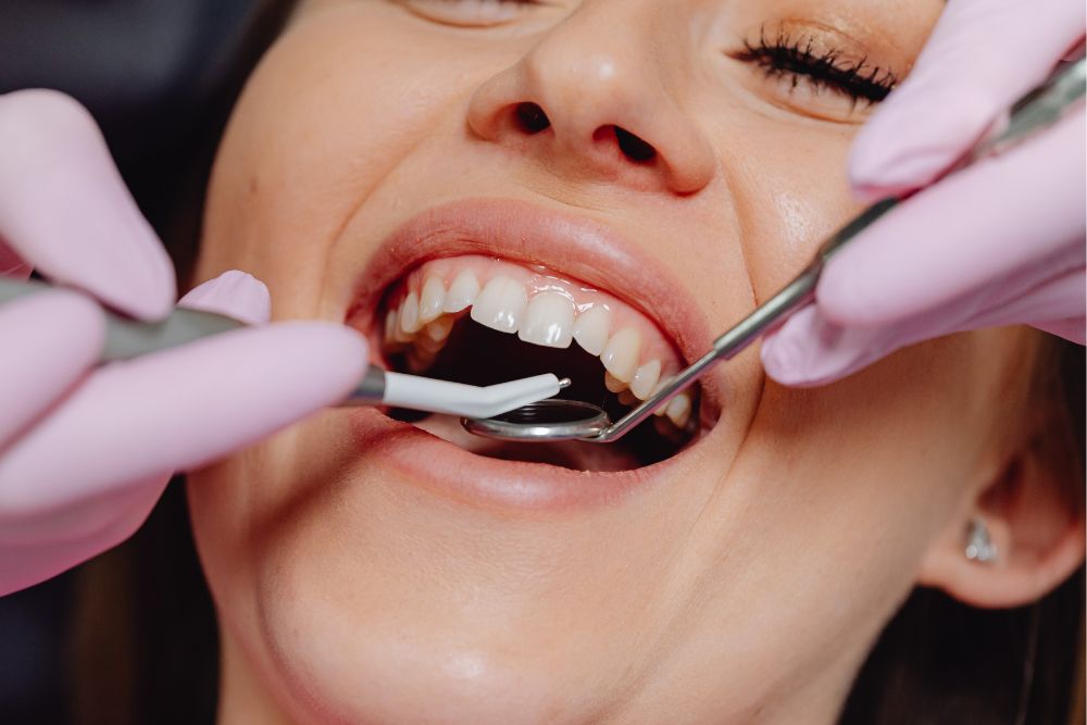 Is a Rotten Tooth a Dental Emergency