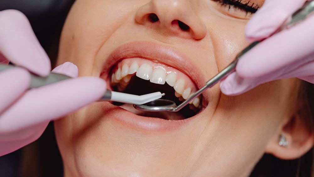Restore Your Smile with Dental Implants in Jersey City