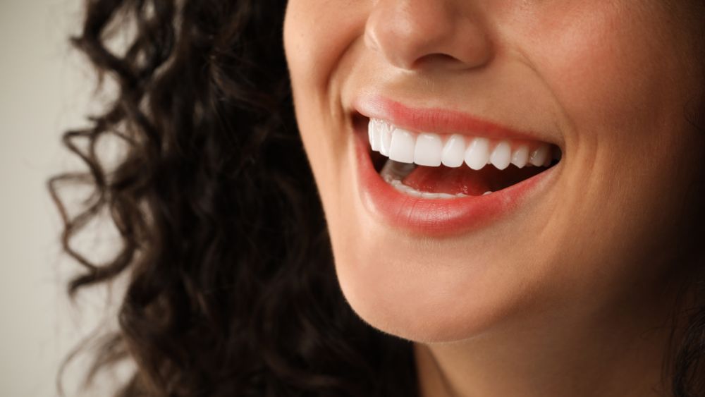 Porcelain Veneers