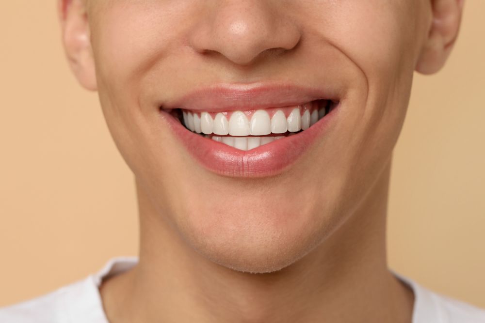 A close-up of a bright, restored smile showcasing the natural results of composite dental bonding at Ararat Dental on JFK Blvd.