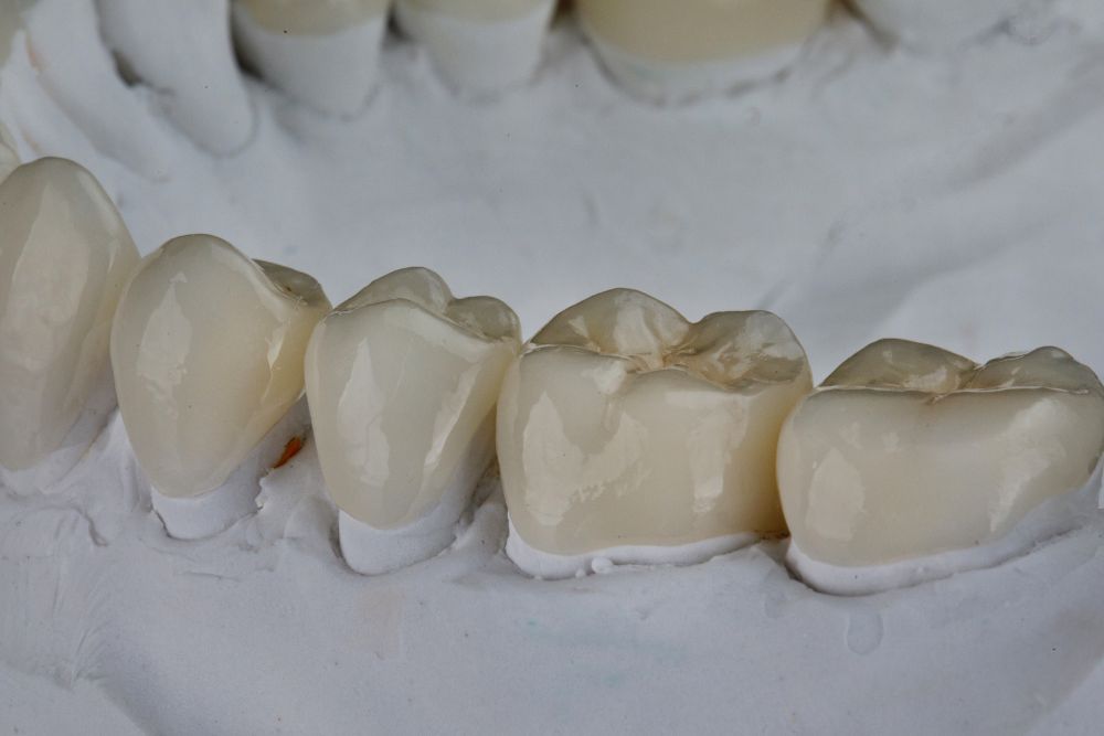 dental crowns jersey city
