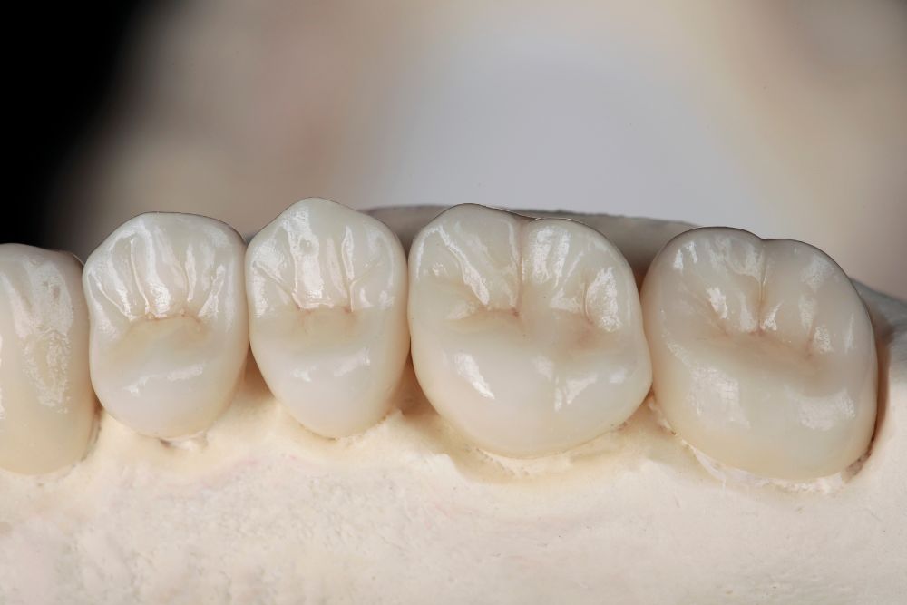 dental crowns jersey city