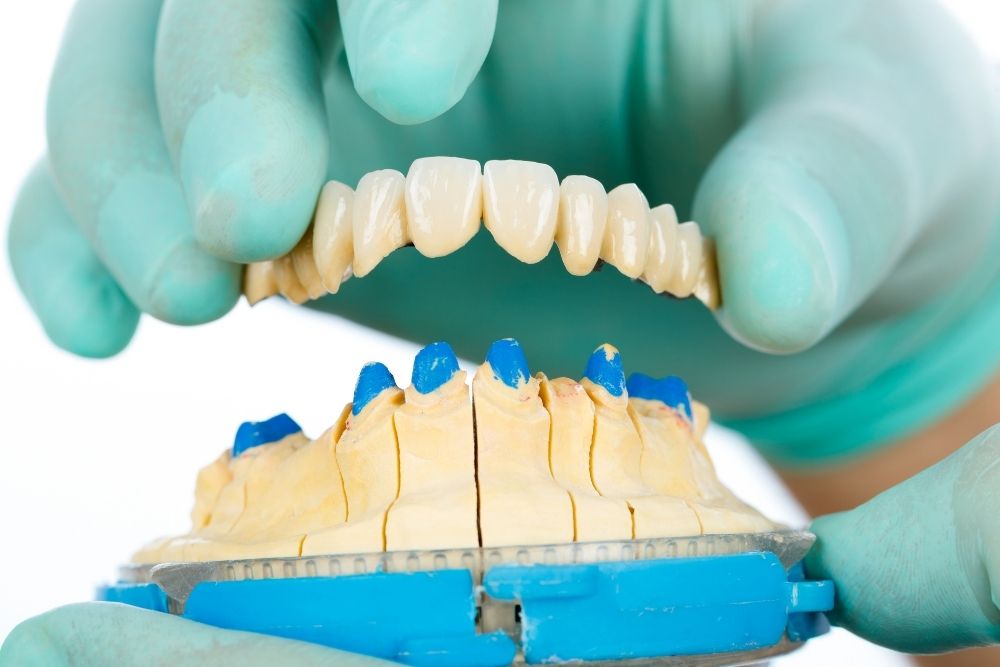 dental bridge jersey city